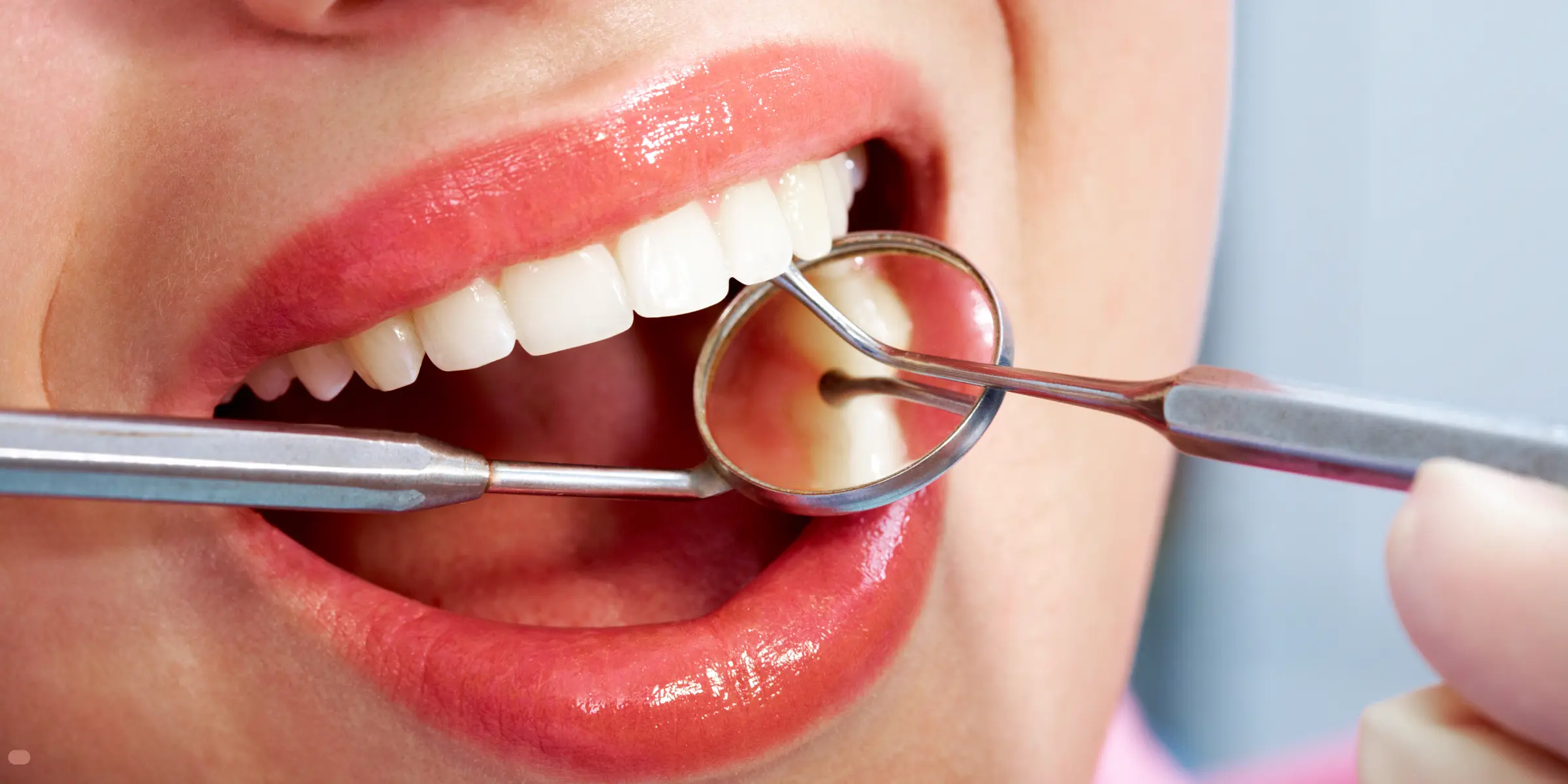 Obturații estetice și plombe dentare la Clinica Pasindora din Râmnicu Vâlcea